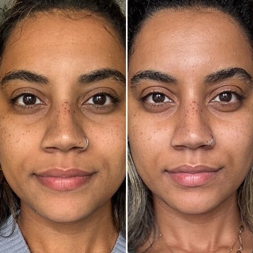 Peau visiblement plus lisse & plus ferme — Masque LED anti-âge Neobody